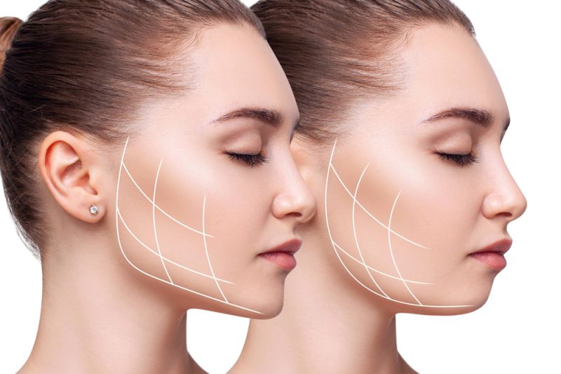 treatment anti wrinkle